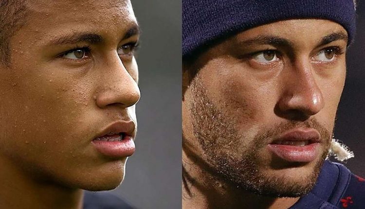 Aparência dos jogadores antes e depois do sucesso