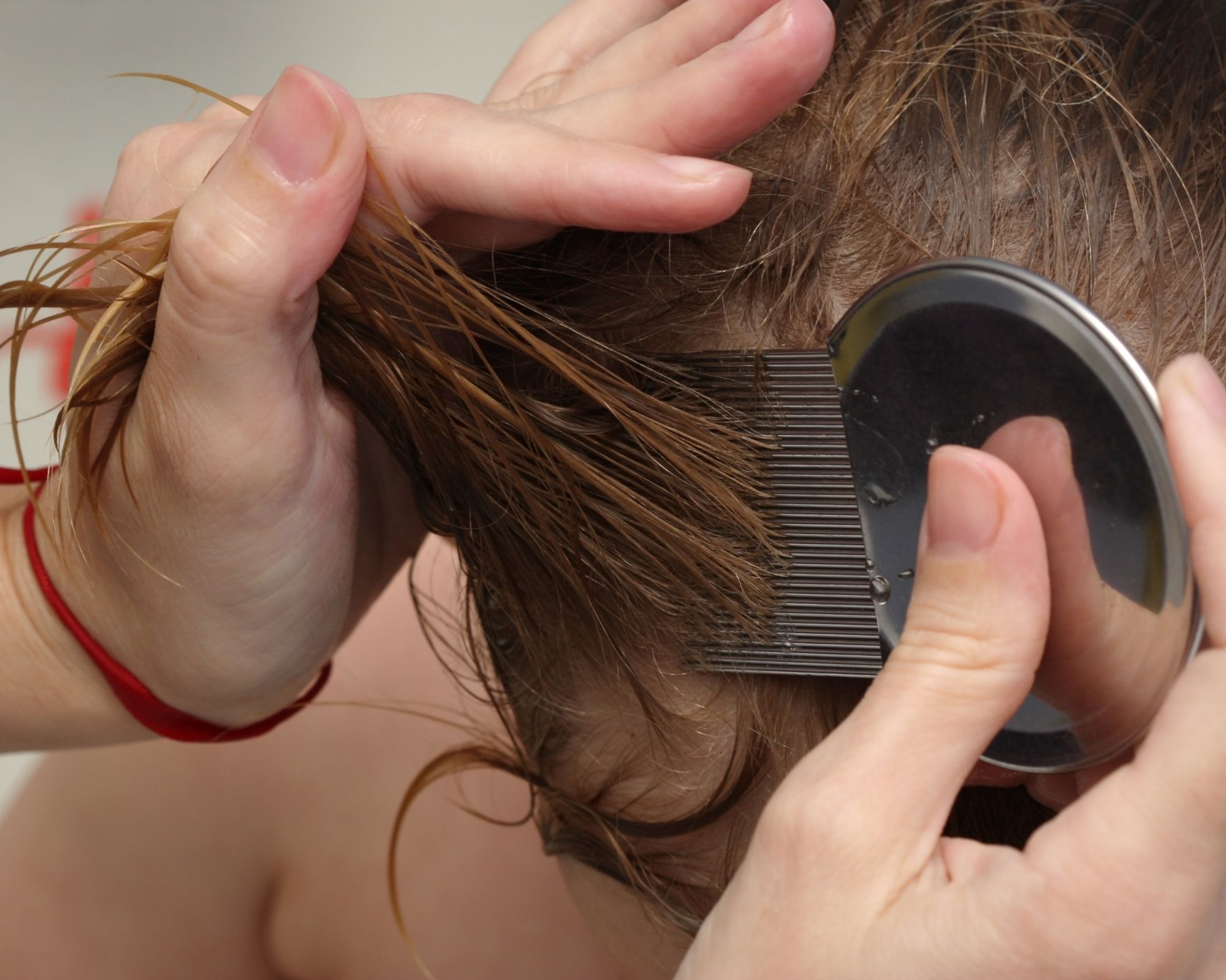 Como saber se é piolho? Aprenda a identificar e como acabar imediatamente/ Fonte: Canva Como saber se é piolho? Aprenda a identificar e como acabar imediatamente/ Fonte: Canva