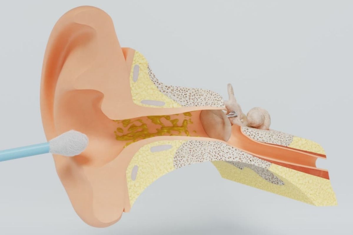 Aprenda o jeito certo de como limpar o ouvido corretamente com cotonete - Foto: canva.