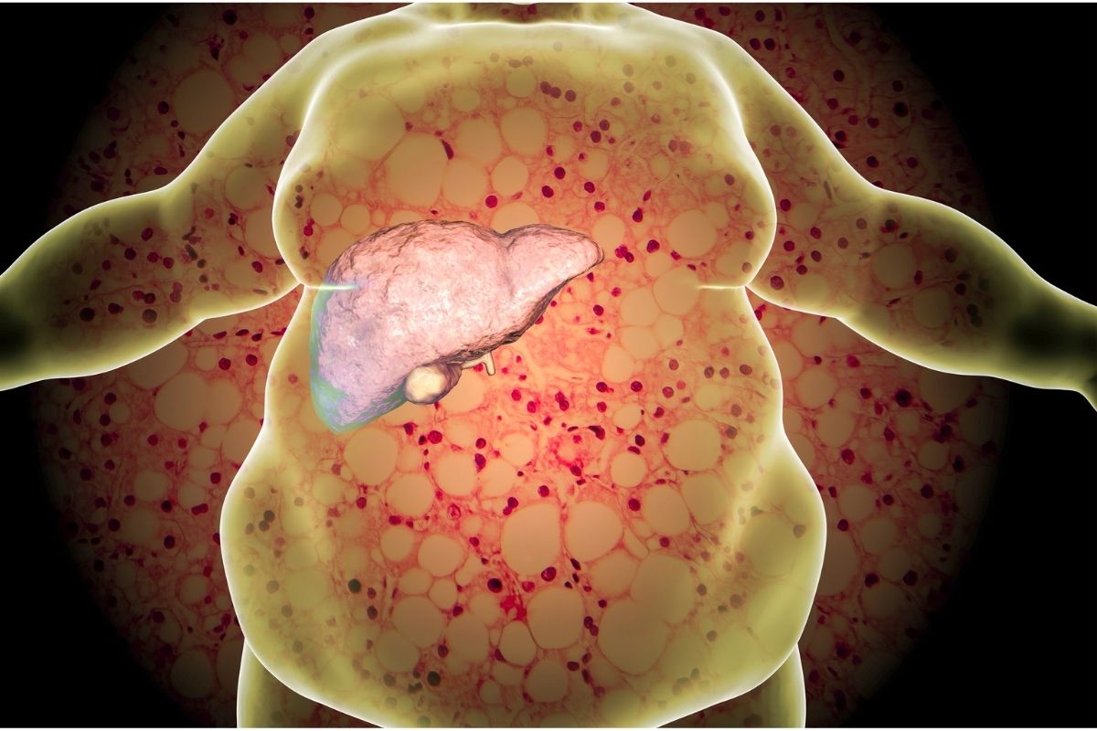 Limpeza hepática como fazer? Desse jeito fica muito melhor Fonte: Canva Limpeza hepática como fazer? Desse jeito fica muito melhor Fonte: Canva