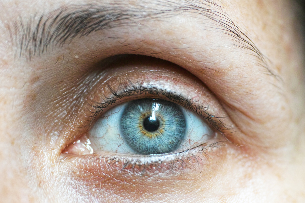 Como fazer para se livrar das olheiras? Veja formas de combater e prevenir olheiras