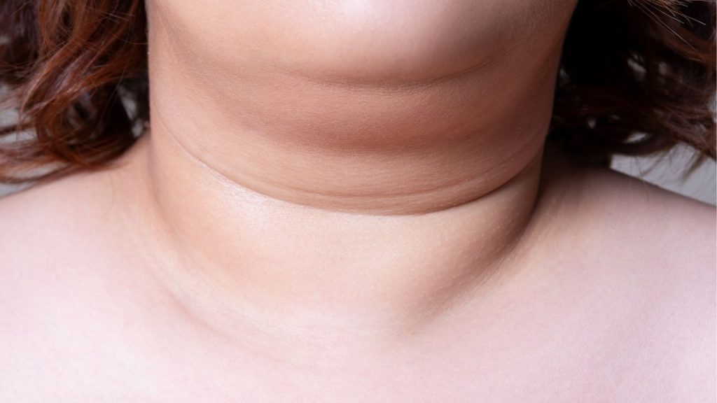 Como disfarçar papada nas fotos? Foto: Canva Pro.