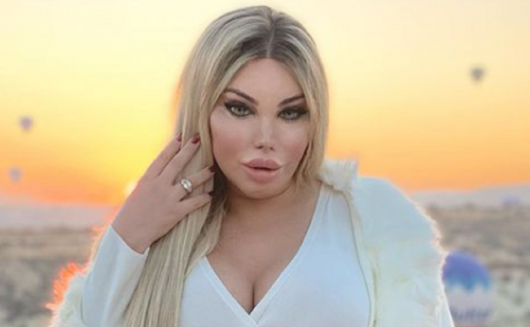 Imagem: Jessica Alves, ex-Ken Humano (Reprodução/Instagram)